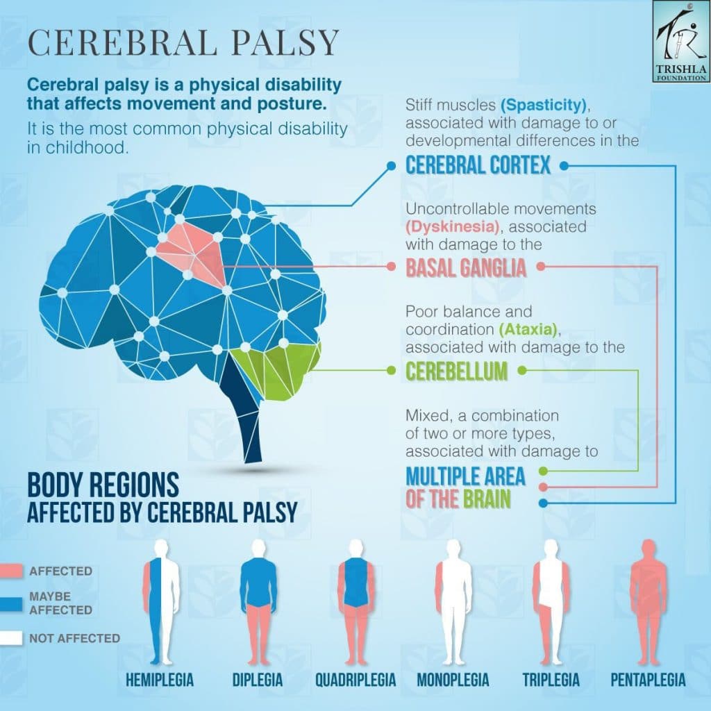 Cerebral Palsy Complete Guide by Trishla Foundation