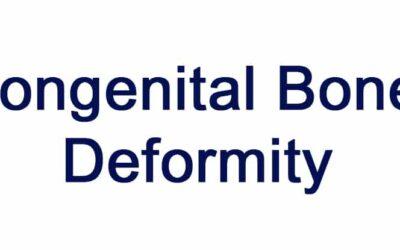 Congenital Bone Deformity
