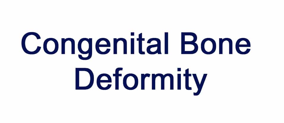 Congenital Bone Deformity