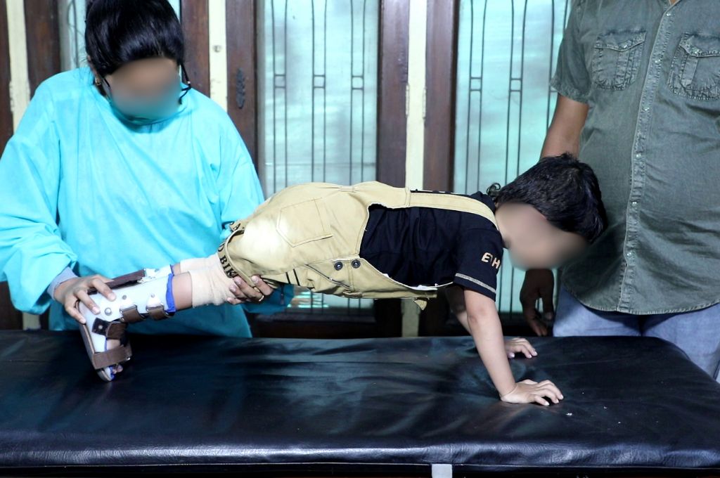 exercises for cerebral palsy