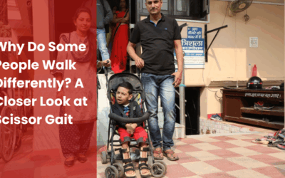 Why Do Some People Walk Differently? A Closer Look at Scissor Gait