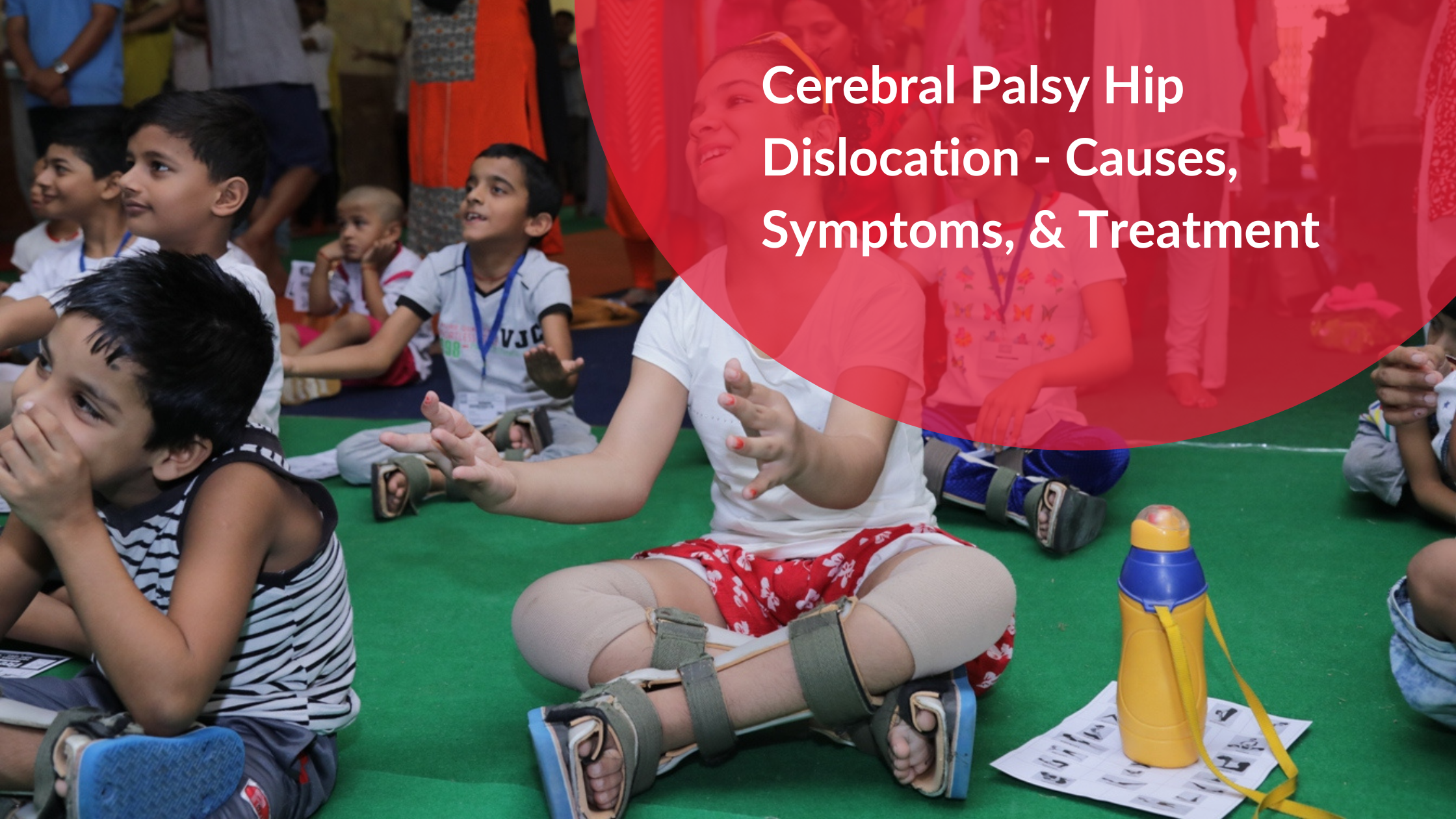 Cerebral Palsy Hip Dislocation - Causes, Symptoms, & Treatment