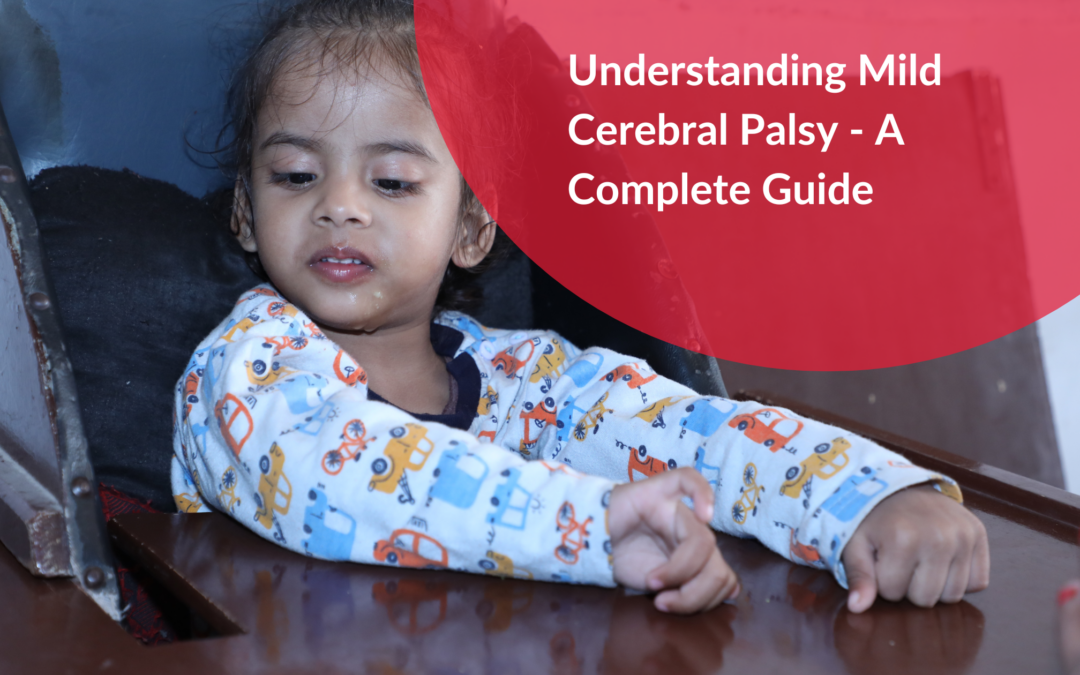Understanding Mild Cerebral Palsy – A Complete Guide