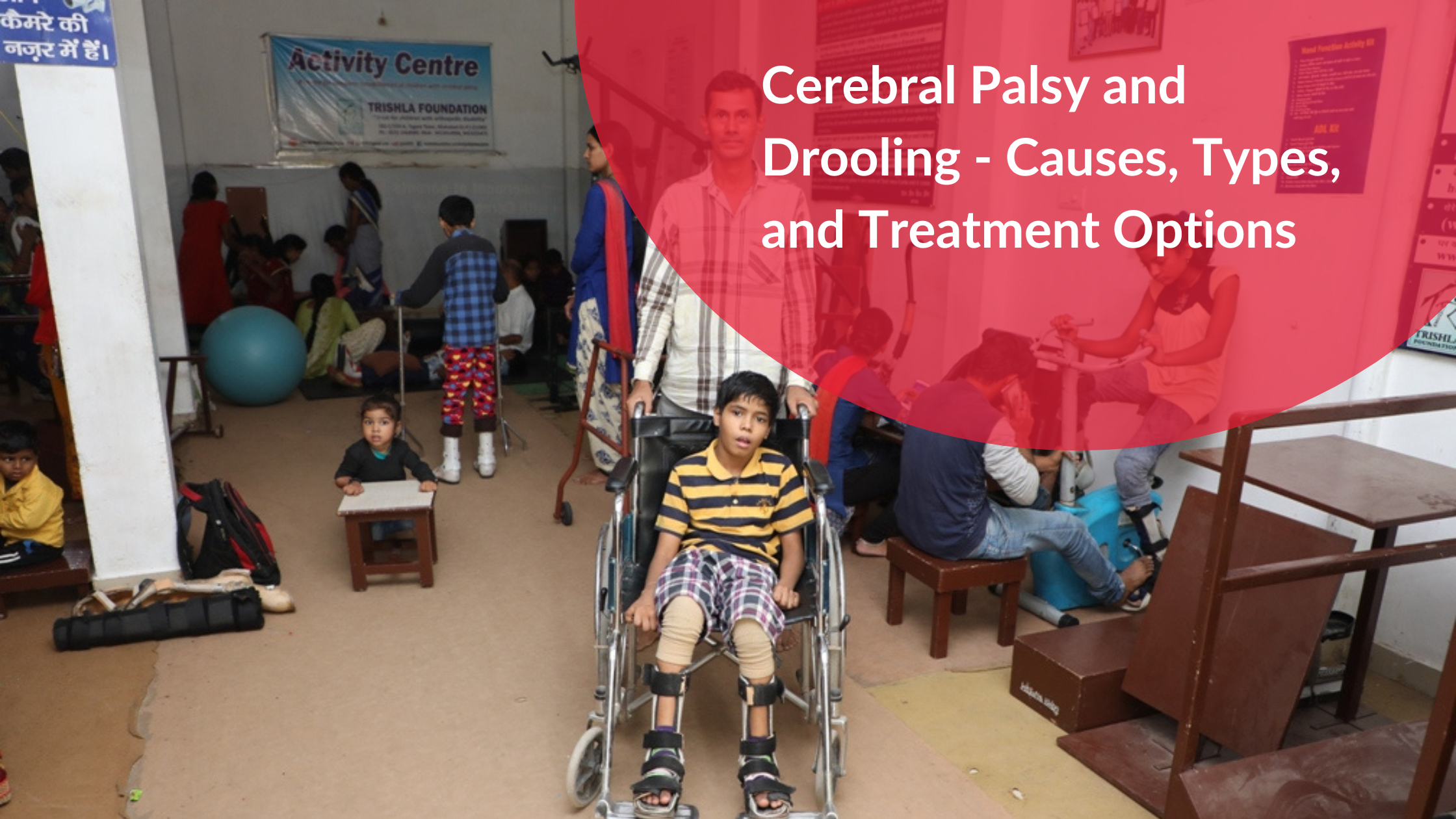 Cerebral Palsy and Drooling – Causes, Types, and Treatment Options Cerebral Palsy and Drooling - Causes, Types, and Treatment Options