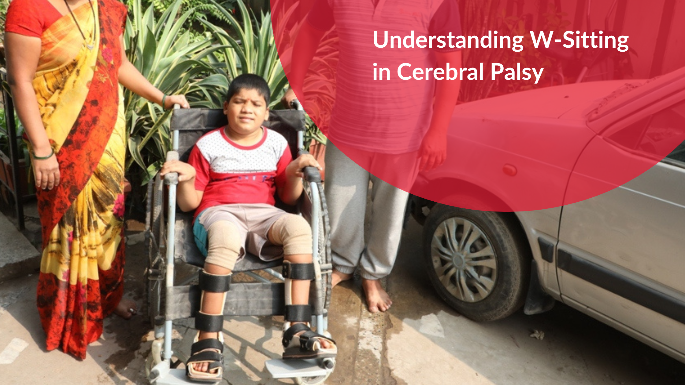 Understanding W-Sitting in Cerebral Palsy